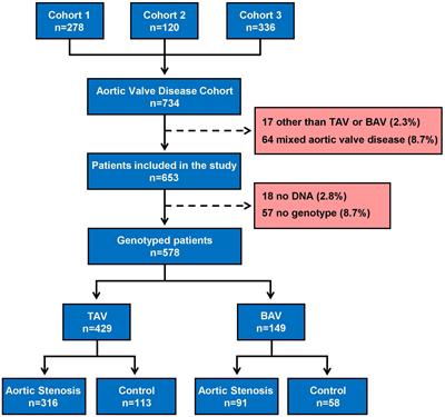 IL6 gene polymorphism association with calcific aortic valve stenosis and influence on serum levels of interleukin-6